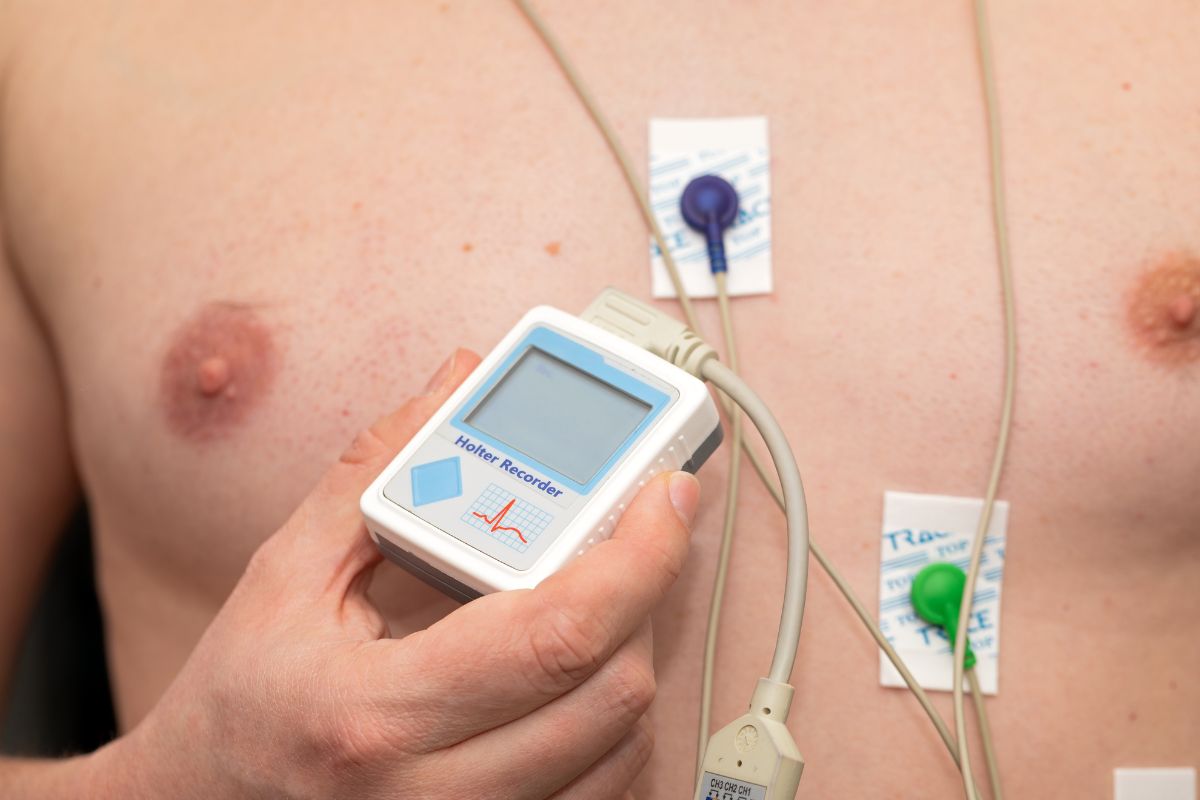 Holter ECG: Monitoraggio continuo per una diagnosi accurata delle patologie cardiache